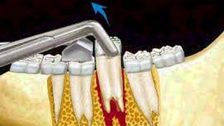 Understanding Equine Dentistry: A Comprehensive Guide – Advanced Equine ...