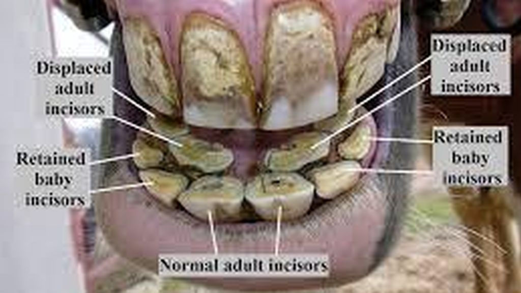 Common Incisor Dental Issues